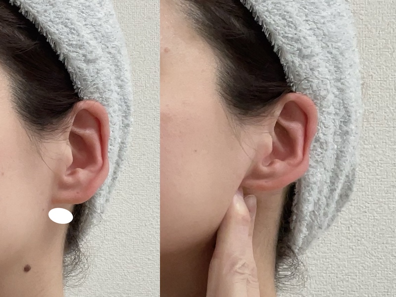 耳マッサージのやり方⑥耳の下をほぐす